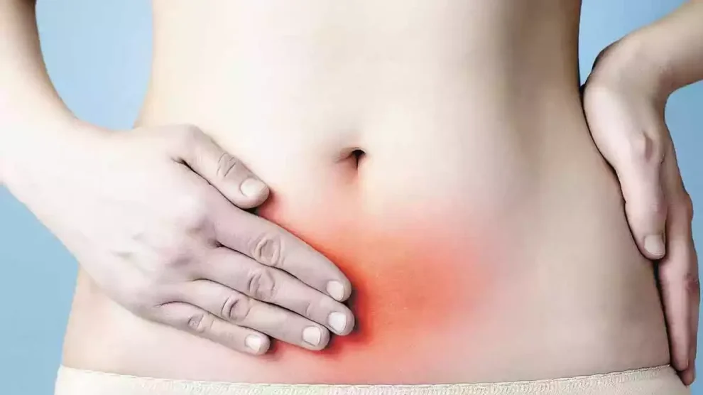 Endometriose - Dra. Iramis Maria Camejo Solano